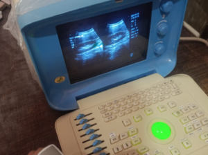 Ultrasound Machine for sale, Contact; 0302-5698121