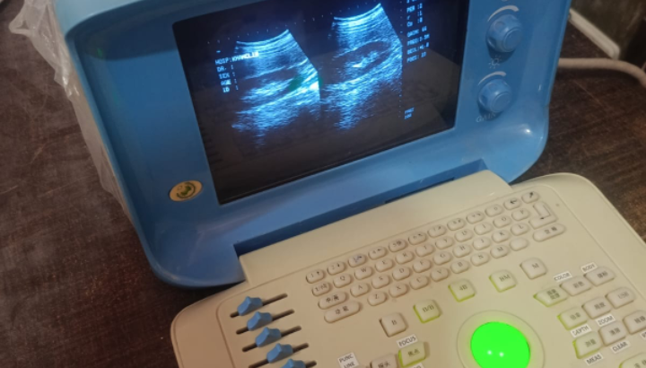 Ultrasound Machine for sale, Contact; 0302-5698121